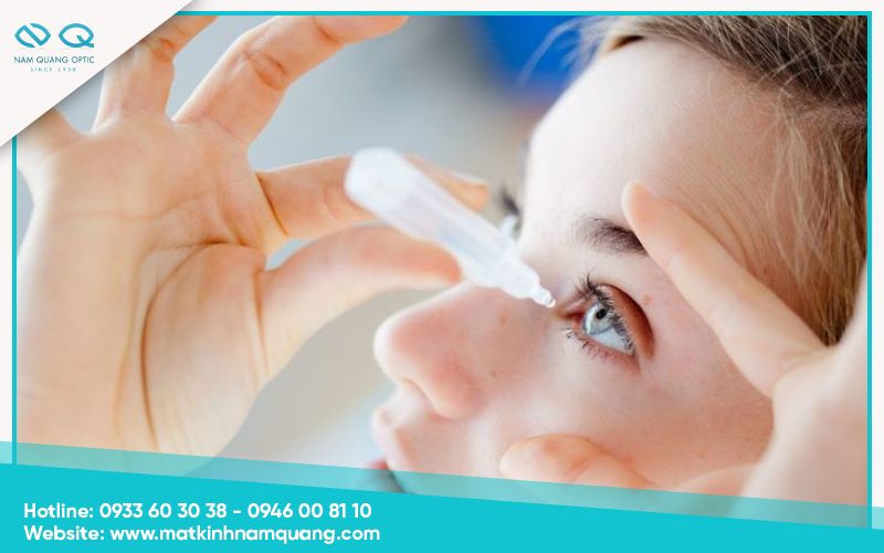 lưu ý khi mổ mắt cận