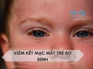 Viem ket mac mat tre so sinh