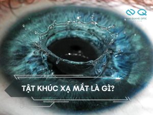tat khuc xa mat la gi