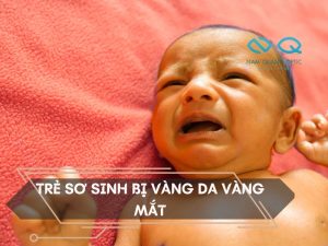 Tre-so-sinh-bi-vang-da-vang-mat