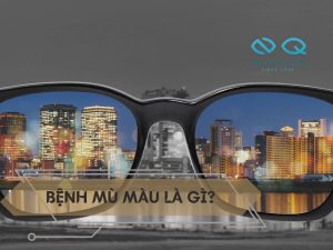 benh mu mau la gi