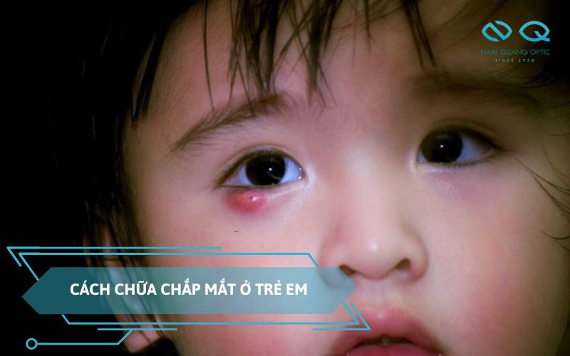 cách chữa chắp mắt ở trẻ em