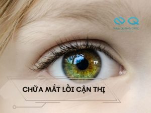 chua mat loi can thi