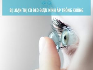 bị loạn thị có đeo được kính áp tròng không