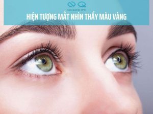 hiện tượng mắt nhìn thấy màu vàng