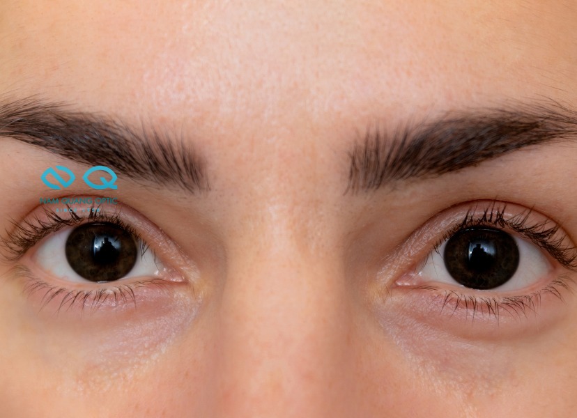 Mắt Nâu Đen (Dark Brown Eyes)