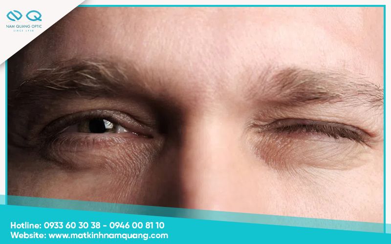 Mắt trái giật có nguy hiểm không?