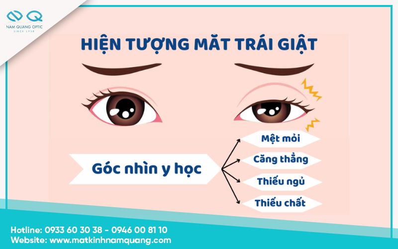 Mắt trái giật là bệnh gì?