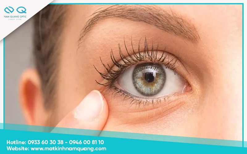 Kiểm tra độ sâu của hốc mắt Kiểm tra độ sâu của hốc mắt