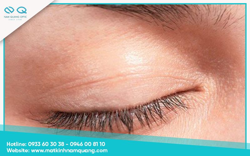 Bảo vệ mí mắt và hạn chế ung thư