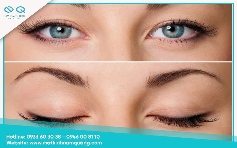 Bài tập chớp mắt chủ động