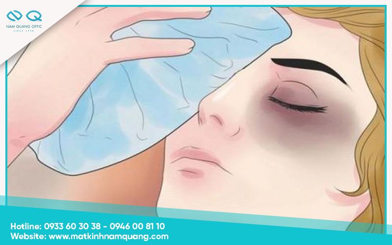 Cách sơ cứu, cách trị đau mắt hàn xì sau khi tiếp xúc với tia lửa điện tại nhà