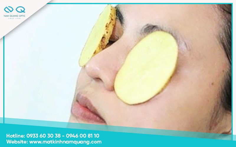 Cach-tri-dau-mat-han-hieu-qua-8 Đắp khoai tây