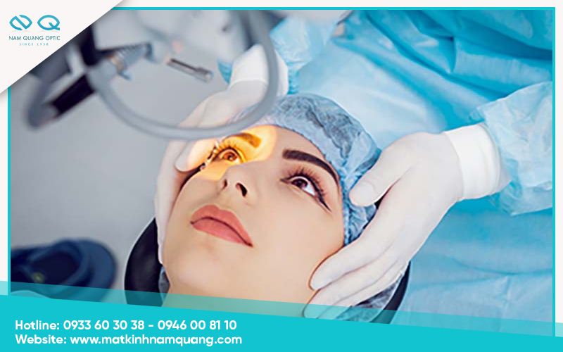 Phẫu thuật LASIK