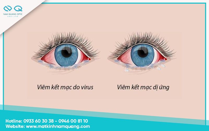 Chuom-nong-mat-co-tac-dung-gi-15 Chườm khi mắt đang viêm hoặc có vết thương