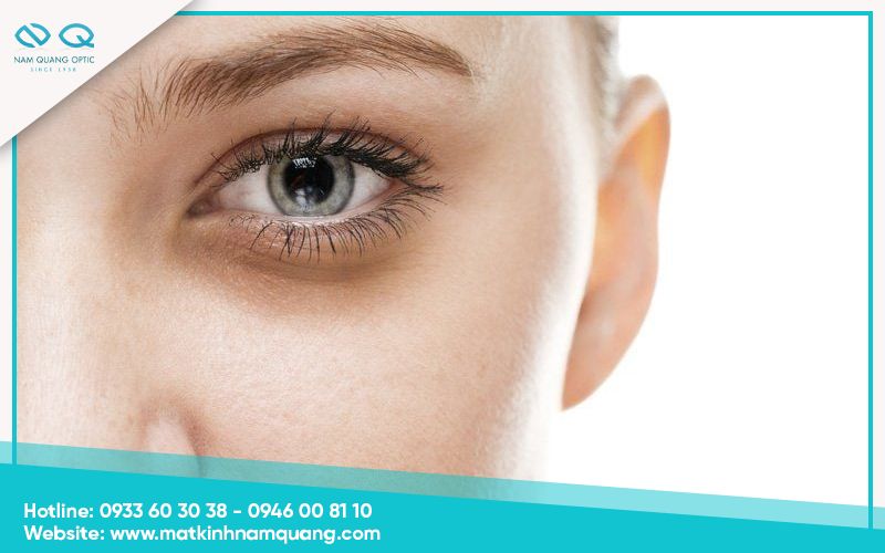 Chuom-nong-mat-co-tac-dung-gi-19 Quầng thâm xuất hiện rõ sau thời gian dài làm việc