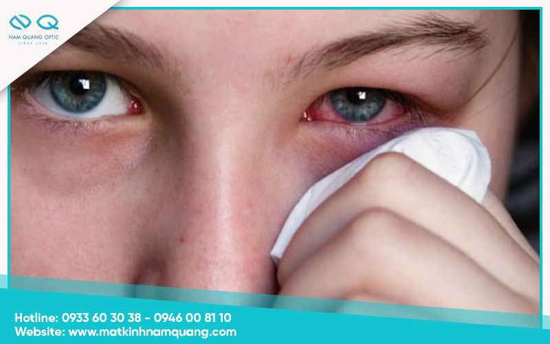 Mắt bị cộm nhưng không có bụi có sao không?