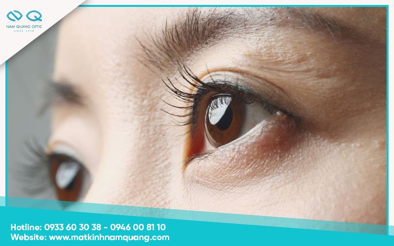 Tầm quan trọng của việc duy trì mắt chính thị