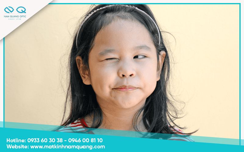 Cách nhận biết biểu hiện nháy mắt ở trẻ em cần đi khám ngay
