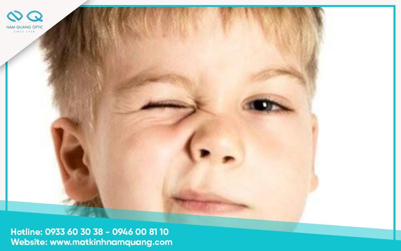 Nháy mắt ở trẻ nhỏ có tự hết không?