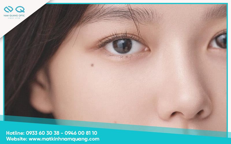 Nốt ruồi dưới mắt trái​ có ý nghĩa gì? Hé lộ về vận mệnh, tướng số