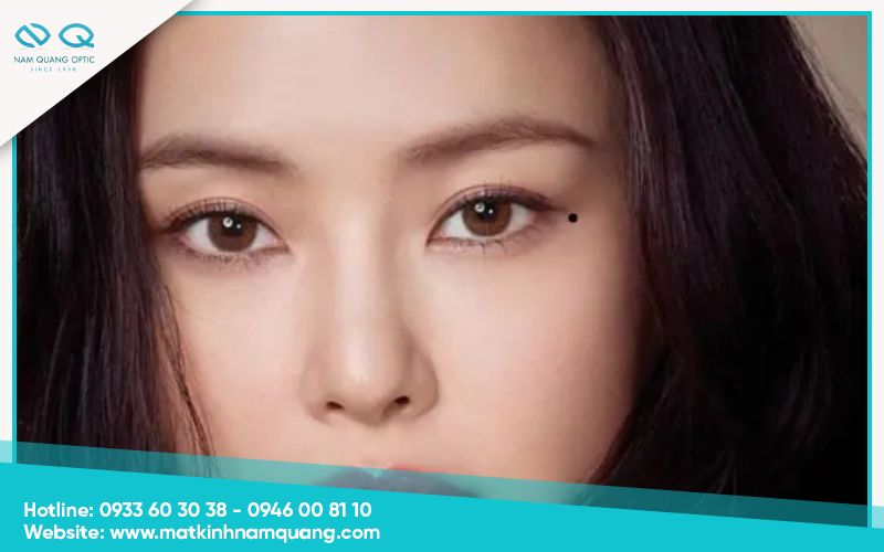 Nốt ruồi ở đuôi mắt