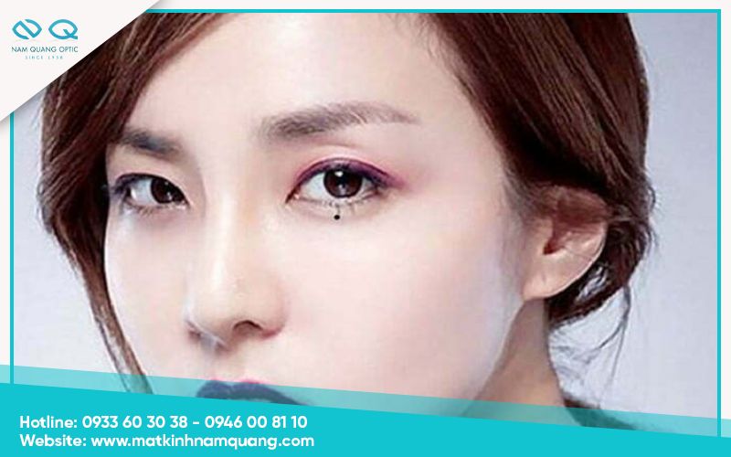 Nốt ruồi ở bọng mắt