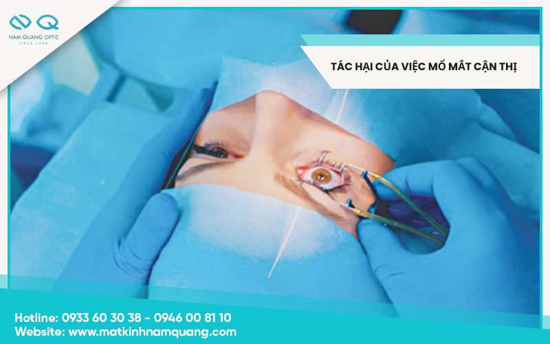 Tác hại của việc mổ mắt cận thị? Những điều cần biết trước khi mổ cận