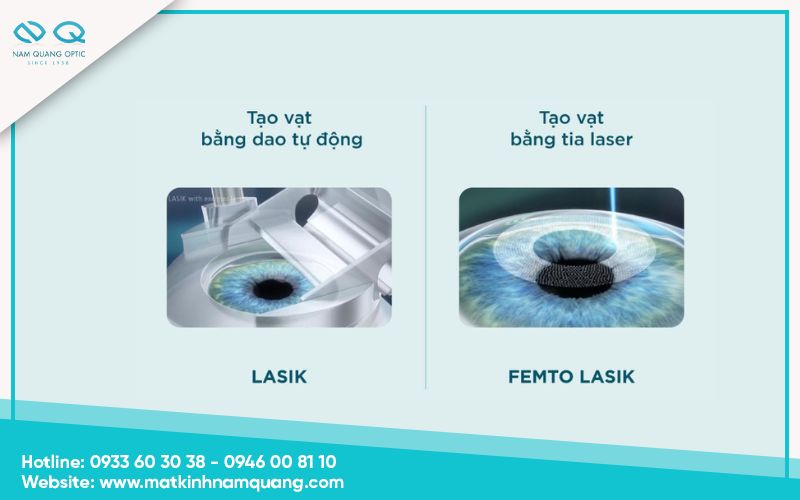 Femtosecond LASIK: Phiên bản cải tiến với độ chính xác cao