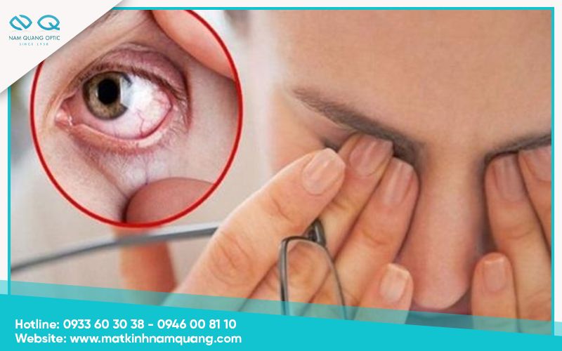 Những lầm tưởng thường gặp về tác hại của việc mổ mắt cận thị