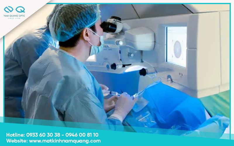 Cách giảm thiểu tác hại của việc mổ mắt cận thị