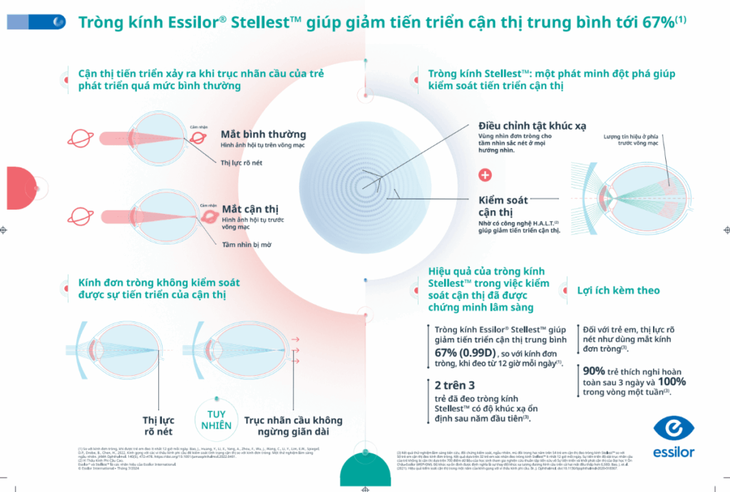 Tròng kính Essilor Stellest công nghệ kiểm soát cận thị
