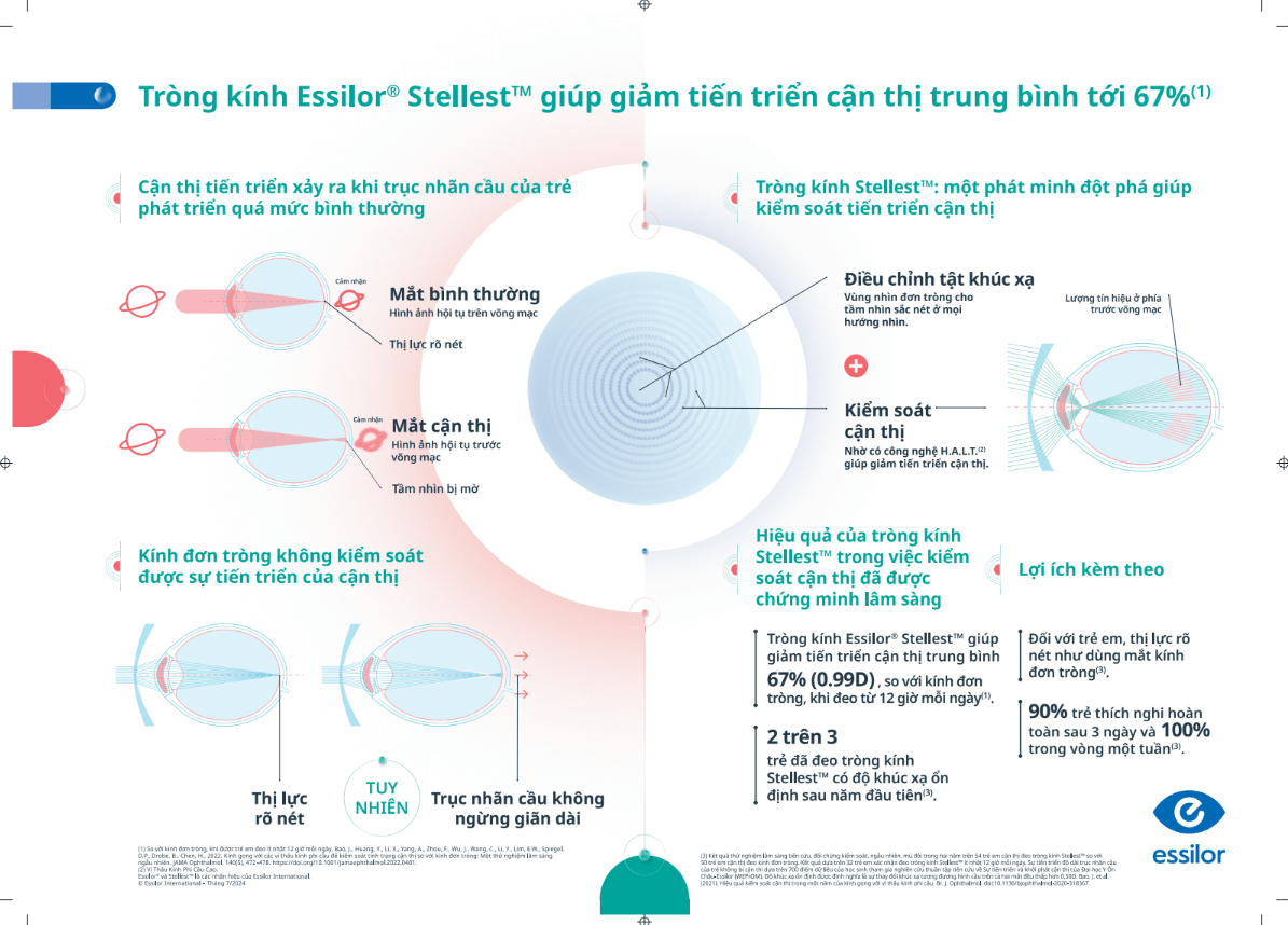 Tròng kính Essilor Stellest kiểm soát tiến triển cận thị Tròng kính Essilor Stellest kiểm soát tiến triển cận thị